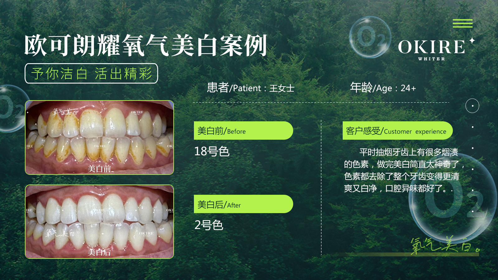 美白案例1