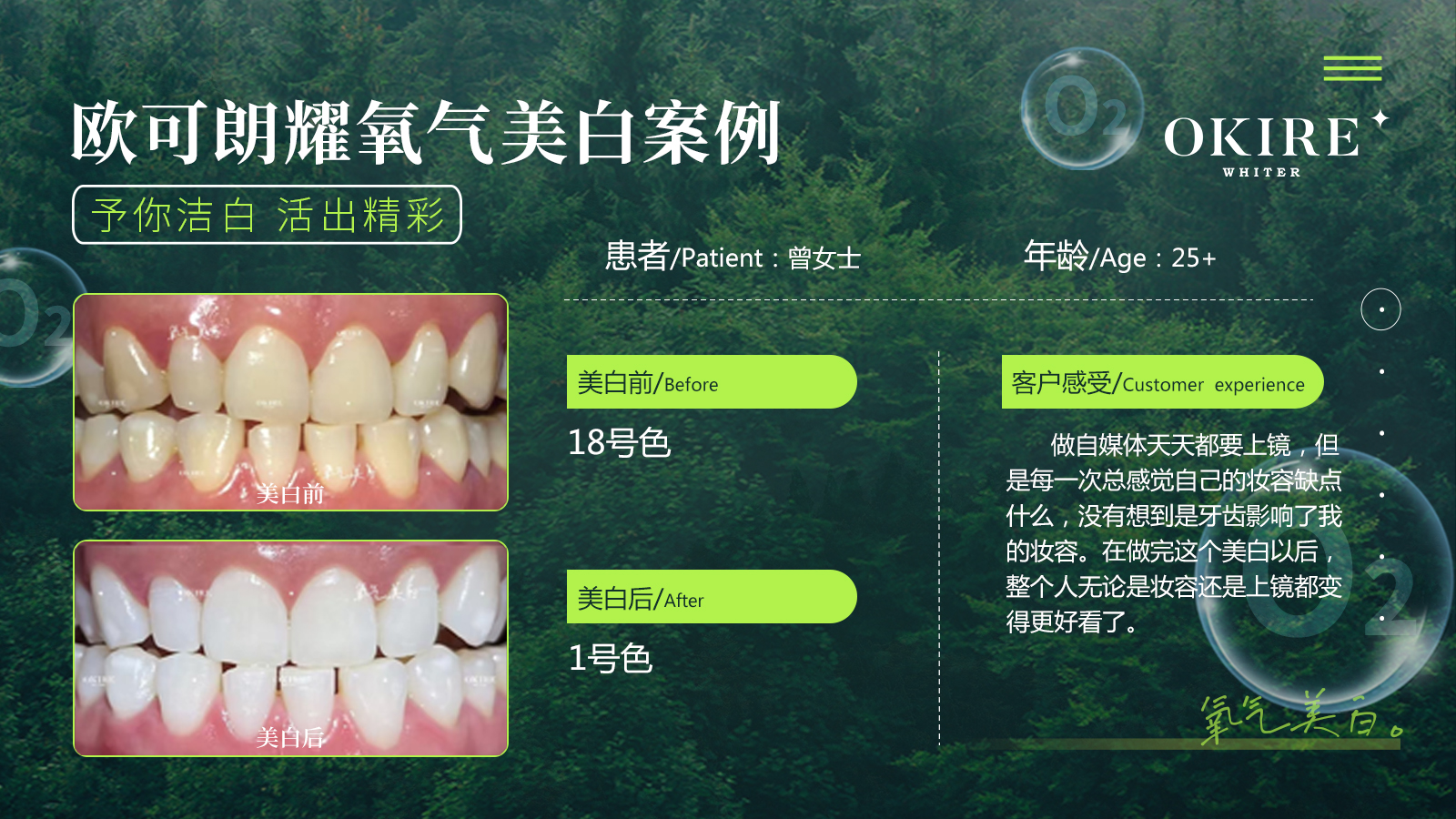 美白案例2