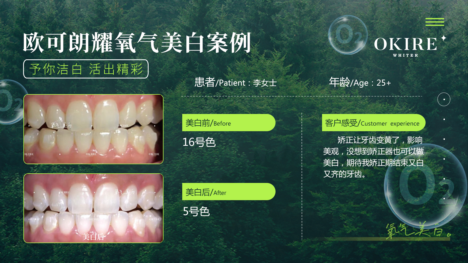 美白案例5