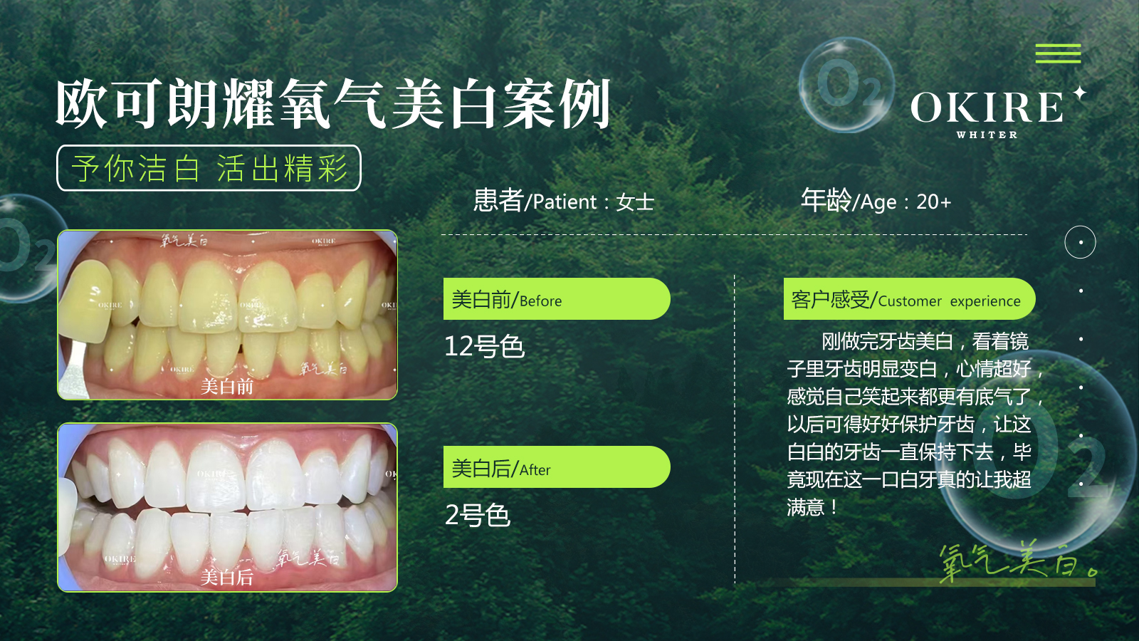 美白案例6