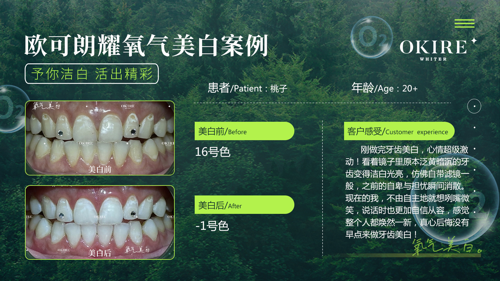 美白案例7