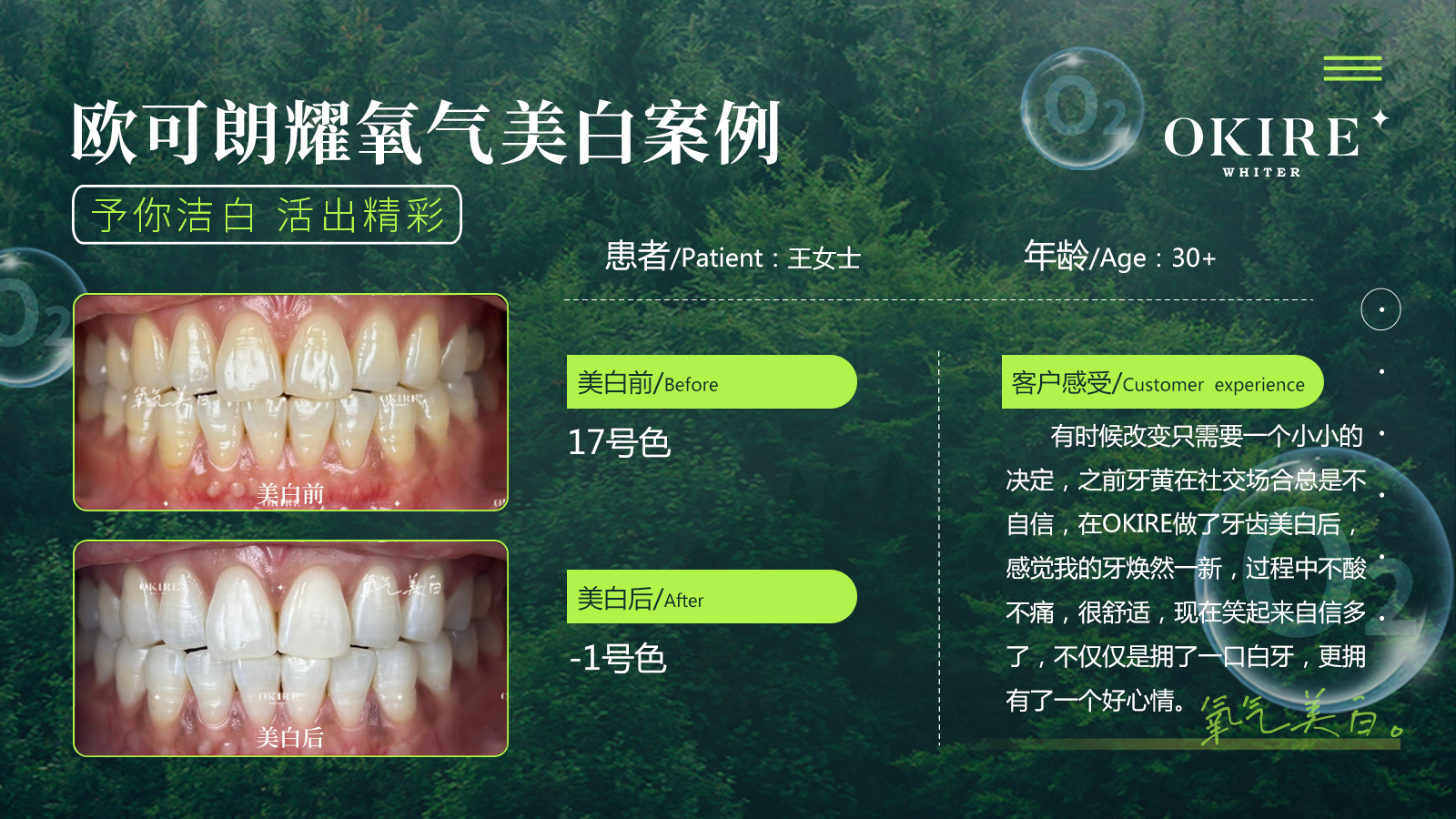美白案例8