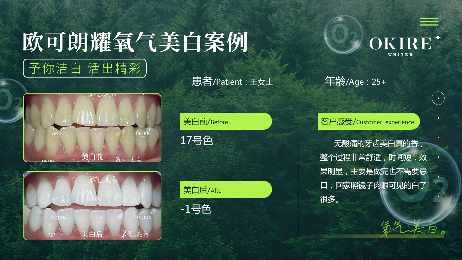美白案例9